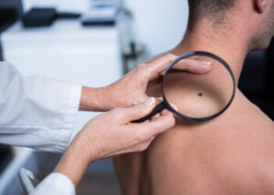 how often should you get skin check procedures chatswood