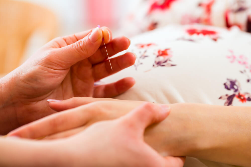pregnancy induction acupuncture
