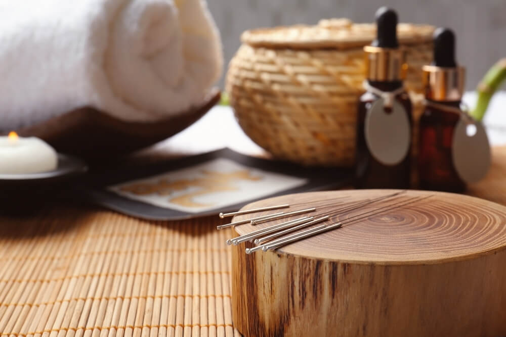 Finding the Best Acupuncturist Near Me: A Guide to Holistic Healing in Your Area